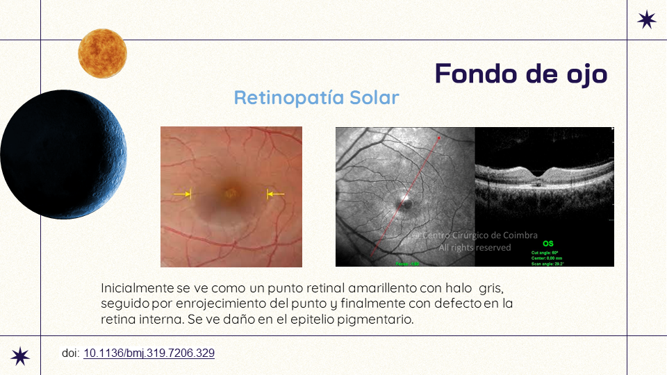 Cuidado de ojos